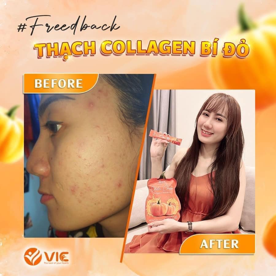 Thạch Bí Đỏ Chen Chen Vic chính hãng hỗ trợ giảm thâm nám Thạch Bí Đỏ Chen Chen Vic chính hãng hỗ trợ giảm thâm nám