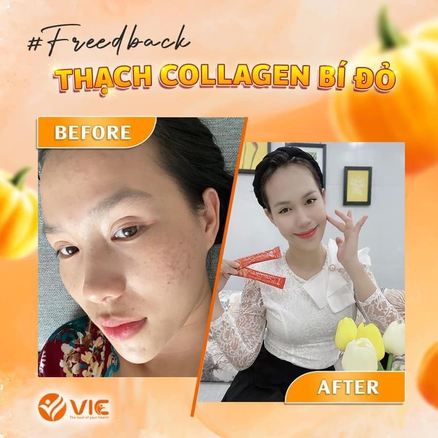 Thạch Bí Đỏ Chen Chen Vic chính hãng hỗ trợ giảm thâm nám Thạch Bí Đỏ Chen Chen Vic chính hãng hỗ trợ giảm thâm nám