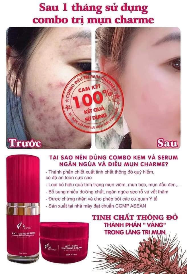 19227-z4294569949526-766be75f00e5ea2fd5e6be4bfc43c98e-3.jpg Serum Mụn Hàn Quốc Charme Anti Acne 15ml - 8809273480227