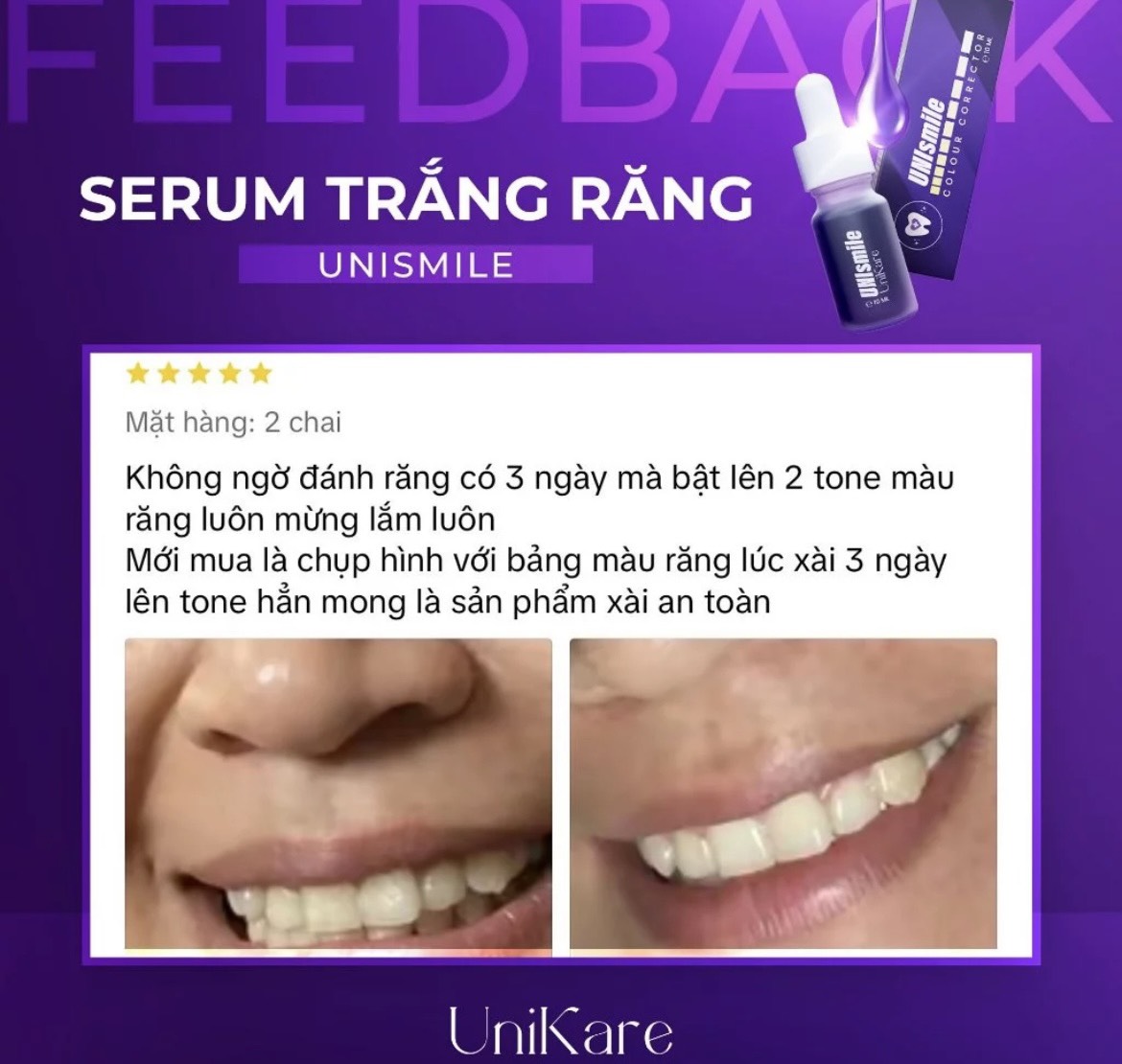 24535_z5537365845403-4273010c864a0ef83b8d71f40ef8aea9_20240614160845-10.jpg Serum Trắng Răng Unismile Unikare 10ml - SRUNISMILE01