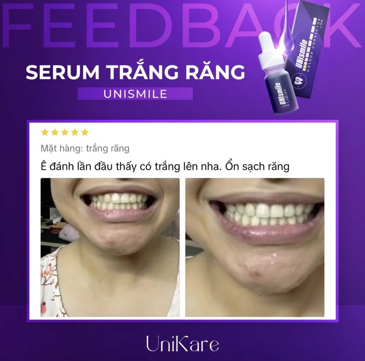 24535_z5537365860233-d2c5e76cd9eb49a837c40619ed6c761a-1_20240614160846-8.jpg Serum Trắng Răng Unismile Unikare 10ml - SRUNISMILE01