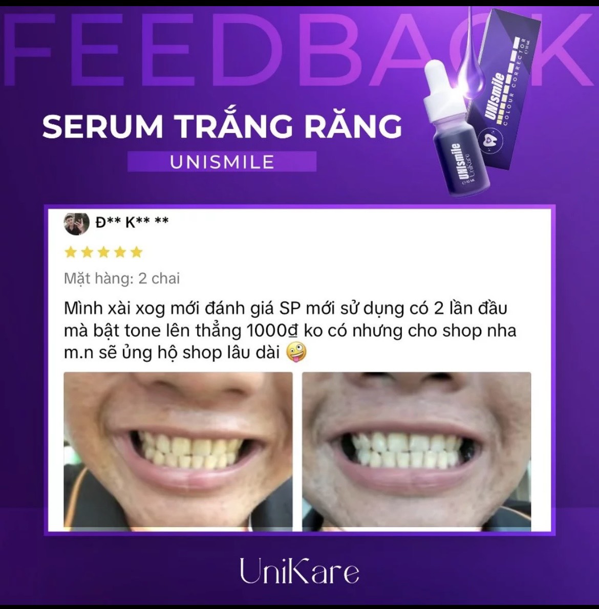 24535_z5537365878382-4cc74947b2c1c4774ce221cbe8790c38-1_20240614160847-7.jpg Serum Trắng Răng Unismile Unikare 10ml - SRUNISMILE01