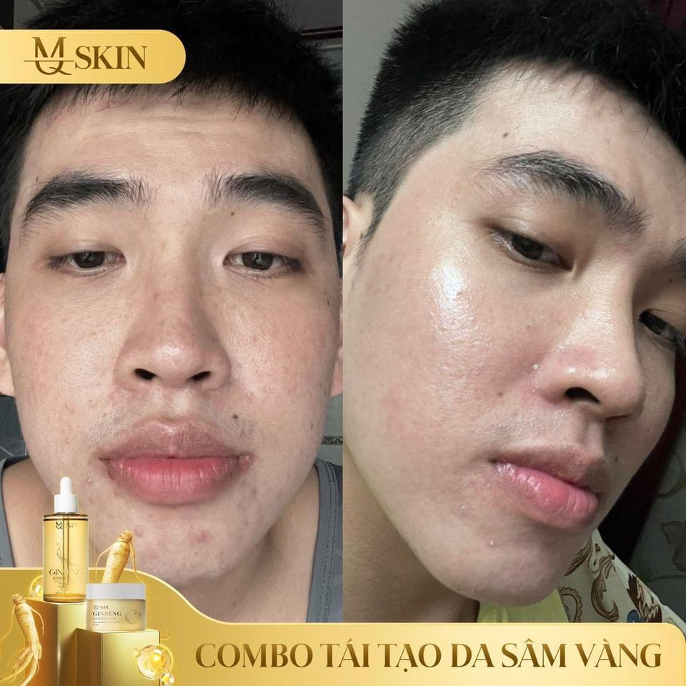 24549_z5541099569541-996e7e4db72cbadae4fd4300a12d3521_20240616113248-1.jpg Combo Tái Tạo Sâm Vàng MQ Skin - CBTTSAMVANG