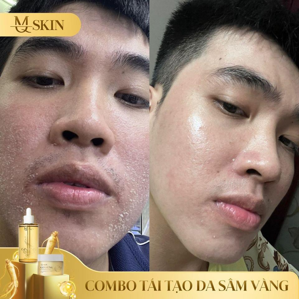 24549_z5541099572765-4f96f56776f5606e800ce7ee252e7abe_20240616113249-1.jpg Combo Tái Tạo Sâm Vàng MQ Skin - CBTTSAMVANG