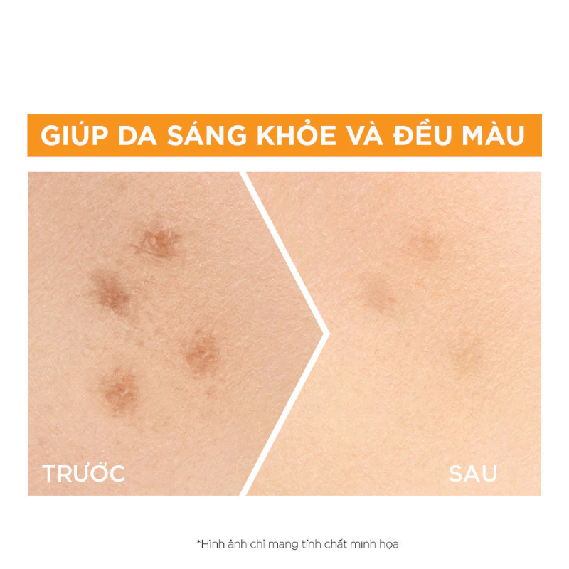 25365_phu-photoroom-2_20241005173329-2.png Serum Garnier Dưỡng Sáng Da Skin Naturals Bright Complete 30x Vitamin C Booster Serum 30ml - 8994993011421