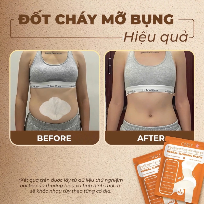Miếng Dán Tan Mỡ Đông Y Tây Tạng Ohio Slimming Patch Miếng Dán Tan Mỡ Đông Y Tây Tạng Ohio Slimming Patch