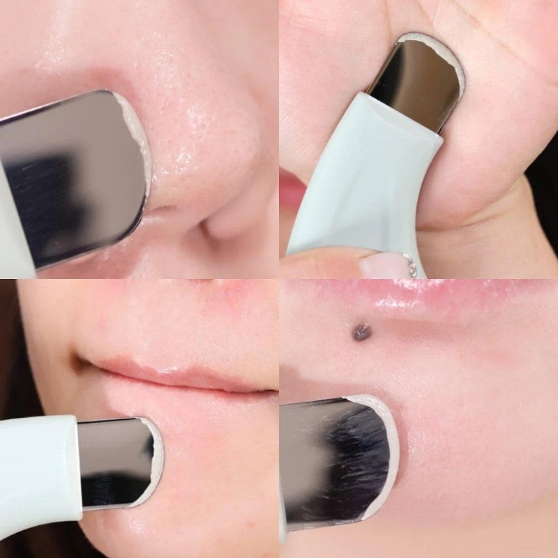 25806_thanh-day-mun-ilso-photoroom-4_20241122172311-11.png Combo Tinh Chất Ủ Mụn Đầu Đen 150g + Cây Đẩy Mụn Đầu Đen ILSO Giúp Sạch Bã Nhờn Sáng Da - ILSO02