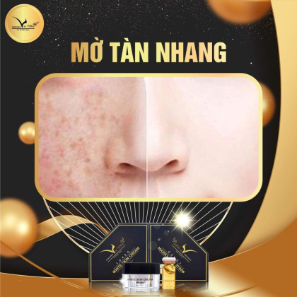 Kem Face VIP White da trắng hồng bật tông không hề khó