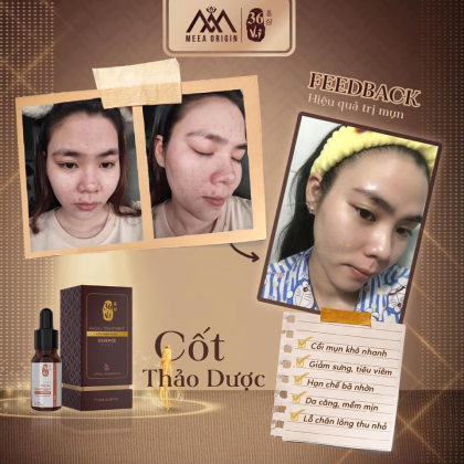 Serum Cốt Huyết Thanh Thảo Dược 36 Vị Full 10ml MeeA Origin chính hãng
