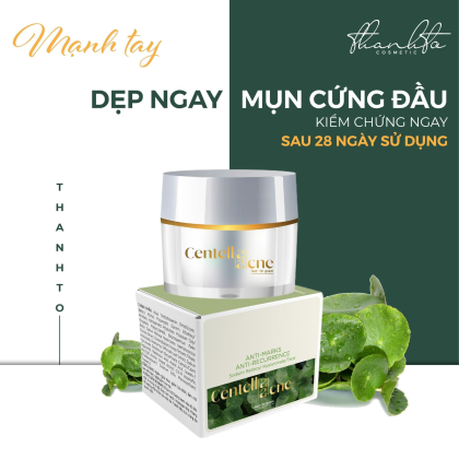 Kem Face Mụn Rau Má Jiuhe Centella Acne Thanh Tô Cosmetics 10g chính hãng