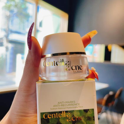 Kem Face Mụn Rau Má Jiuhe Centella Acne Thanh Tô Cosmetics 10g chính hãng