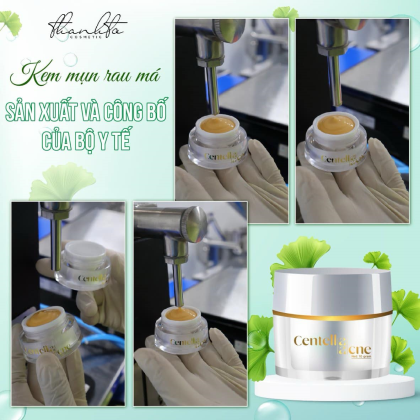Kem Face Mụn Rau Má Jiuhe Centella Acne Thanh Tô Cosmetics 10g chính hãng