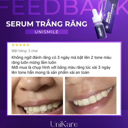 Serum Trắng Răng Unismile 10ML Hỗ Trợ Cải Thiện Ố Vàng Mảng Bám Hôi Miệng