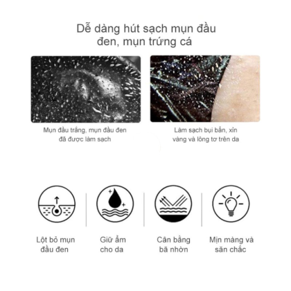 Gel Lột Mụn Nha Đam Okeshop Acne Removal Gel