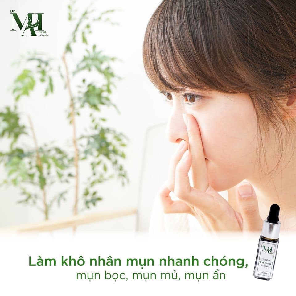 5 lý do cô nàng nào cũng cần 1 lọ Dr. Mai đặc trị mụn