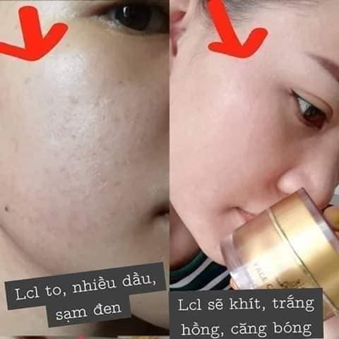 TPHCM chi nhánh phân phối KEM FACE COLLAGEN X3 cty Đông Anh