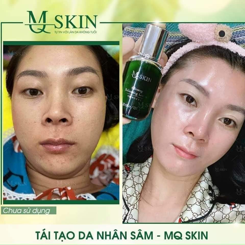 Quá trình sử dụng Kem BB Cream thay da nhân sâm MQSkin