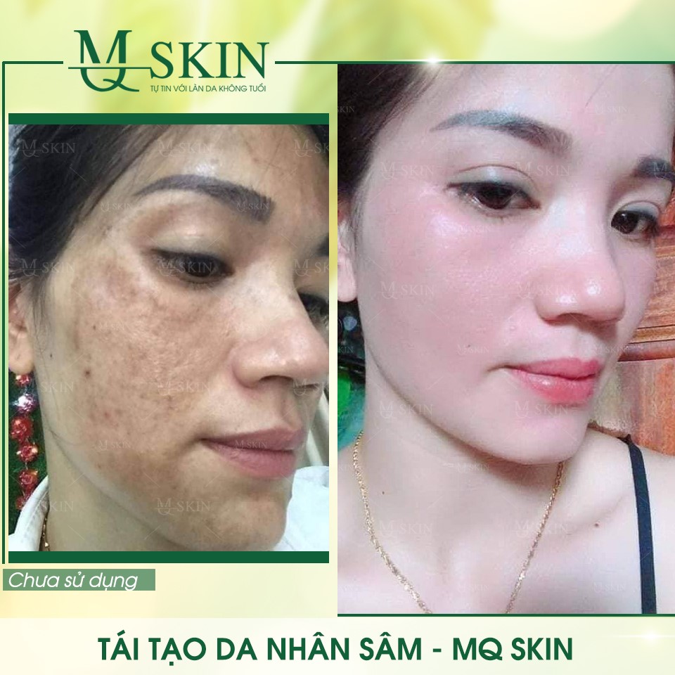 Vì sao "BB Cream tái tạo da MQ Skin" gây siêu bão trên thị trường?