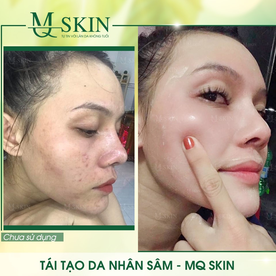 Vì sao "BB Cream tái tạo da MQ Skin" gây siêu bão trên thị trường?