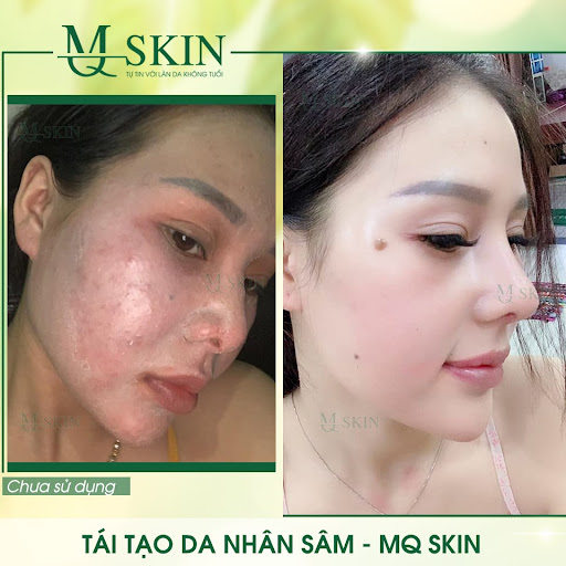 🌺🌺 Với MQ Skin đẹp chính là cách tốt nhất để bạn hạnh phúc hơn mỗi ngày🌺🌺