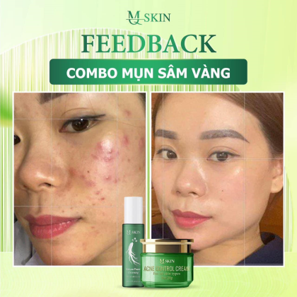 Combo Cao Mụn Sâm Vàng MQ Skin