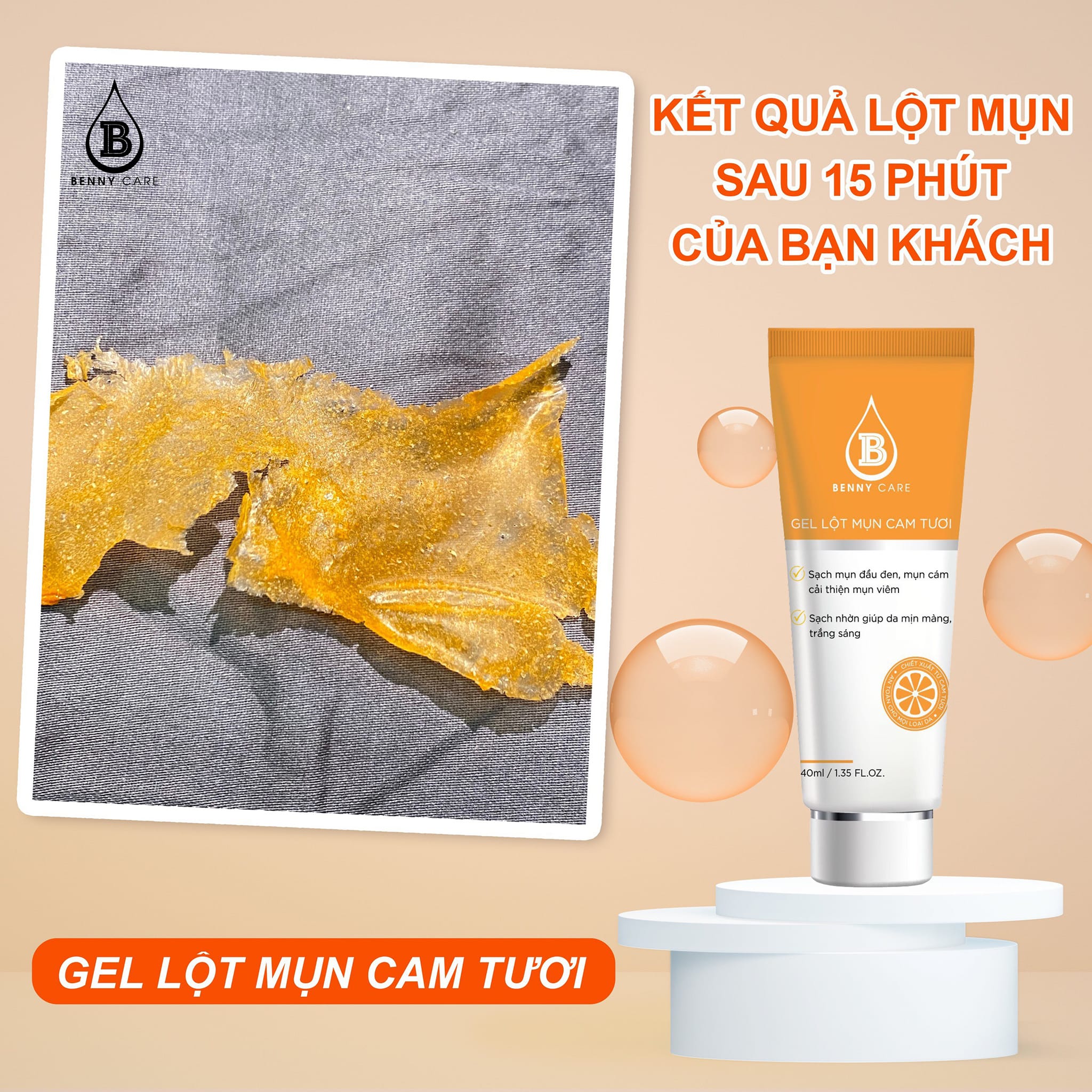 Gel Lột Mụn Cam Tươi MD Beauty Benny Care